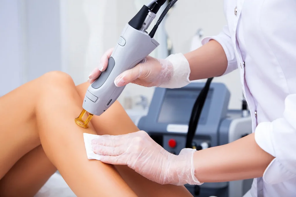 Laser-Hair-Removal